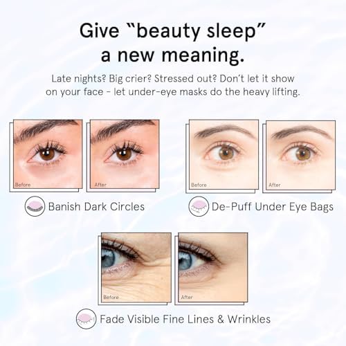 grace & stella Under Eye Masks With Retinol - Revitalizing Under Eye Patches for The Wrinkles & Dark Circles - Gel Eye Mask - Gifts for Mom, Teen Girl Gifts - Vegan, Cruelty-Free (24 Pairs) - 3