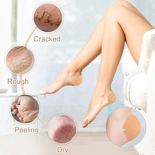 30PCS Patented Cracked Heel Treatment Patches, Cracked Heel Repair Bandage (80mm x 80mm)2