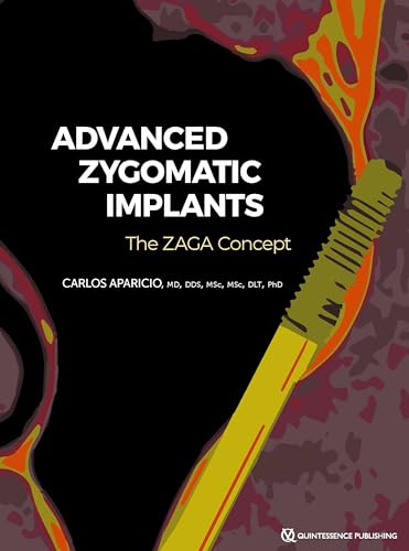 Advanced Zygomatic Implants: The ZAGA Concept (English Edition)
