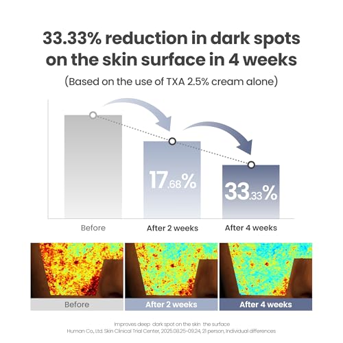 Image of AXIS-Y TXA 2.5% Intensive Brightening Cream - Tranexamic Acid Moisturizer with Niacinamide & Glutathione for Dark Spots & Uneven Skin Tone (1.69 fl. oz.)