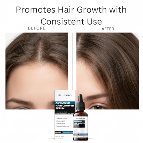 Bio Mystery Hair Growth Serum With 3% Redensyl, 4% Anagain, 3% Biacapil and Capilia longa with Biotin, Rosemerry and Rice Water - For Hair Growth And Hair Fall Control Serum
