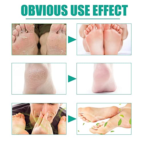 Foot Deodorant Spray,Foot Spray Odor Eliminator Spray,Herbal Foot Peeling Spray,Fungal Combat Feet Spray,Keep Fresh&Dry For A Long Time #TOP5