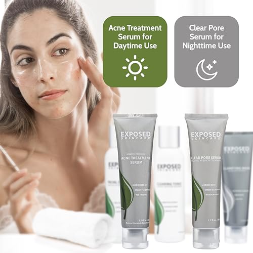 Exposed Skin Care Acne Treatment Kit - Includes Facial Cleanser, Clearing Tonic, Acne Treatment Serum, Clear Pore Serum, Clarifying Mask, Cloth - Natural Acne Solution for Face, All Ages & Skin Types 4 Exposed Skin Care Acne Treatment Kit - Includes Facial Cleanser, Clearing Tonic, Acne Treatment Serum, Clear Pore Serum, Clarifying Mask, Cloth - Natural Acne Solution for Face, All Ages & Skin Types