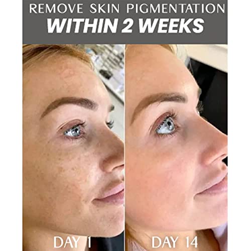 Spotbanish Capsules Whitening Serum, Whitening Capsules Serum, Anti Aging Serum Capsules For Face, Dark Spot Corrector Capsules Serum For Face, Whitening Moisturizer Face Cream Capsules (1Pcs) #TOP5