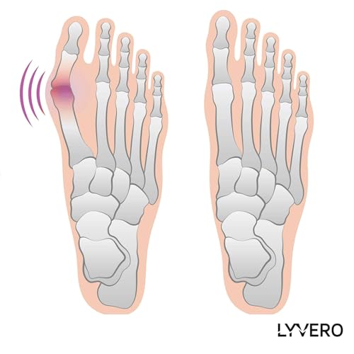 Image of Bunion Corrector Relief Sleeve Big Toe Separator Straighteners, Bunion Correction Socks with Gel Pad Non-Slip Toe Spacer for Women Men Day Night Support Hallux Valgus Guard