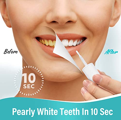 Alsten Teeth Whitening Paint, Tooth Paint, Tooth Polish Uptight White, Instantly Get A Shiny Smile, Easy To Apply #TOP3