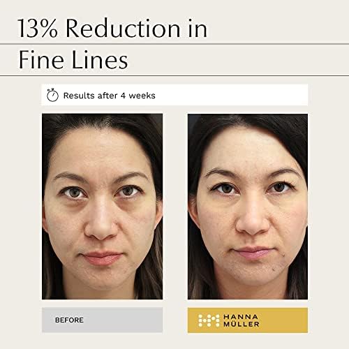  * Under Eye Patches for Puffy Eyes, 24k Gold Eye Masks with Collagen and Snail Peptides, Helps to Reduce Dark Circles, Puffiness and Moisturizing Eye Patch Gel, 30 Pairs