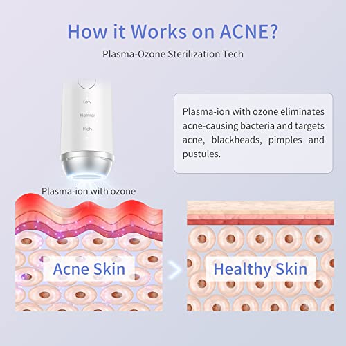 COSBEAUTY-Plasma-Acne-Removal-Peeling-Blackhead-Removal-Device-Face-Massage-Cleaning-Tools-Facial-Machine-White