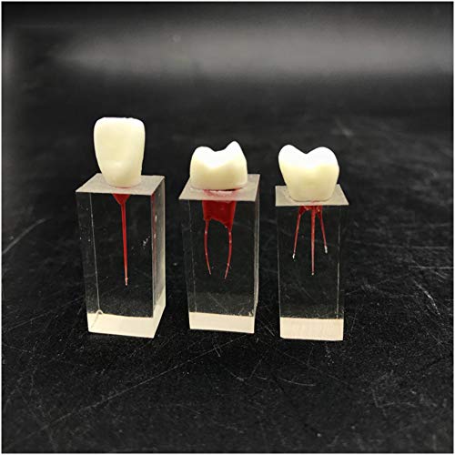 Modelo De Dientes, Modelo Anatómico - Modelo De Obturación De Conducto Radicular con Pulpa Abierta - Modelo De 3 Piezas - Simulación De Diente Oral