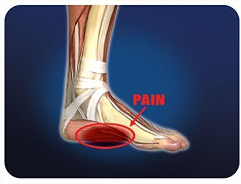 Pro-Tec Athletics Arch Pro-Tec - Premium Arch Support for Plantar Fasciitis