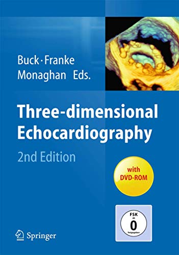 Three-dimensional Echocardiography view 2