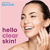 Bye Bye Blemish Acne Drying Lotion, Reduce Pimples Overnight 1oz, 1-Pack