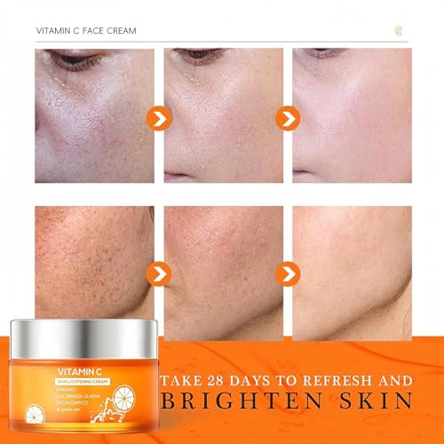Vitamin C Face Cream – Brightening & Anti Wrinkle, Skin Tightening Moisturiser For Women, Hydrate & Plump, Erase Dark Spots & Fine Lines - Image 4