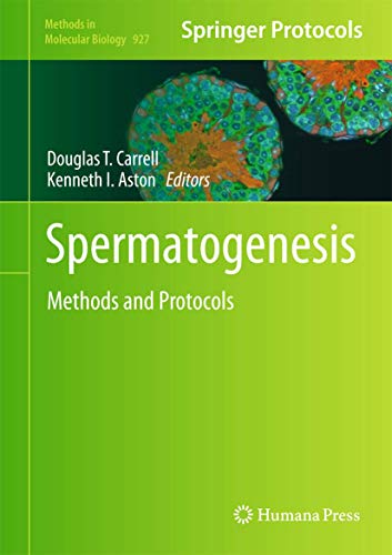 Spermatogenesis: Methods and Protocols (Methods in Molecular Biology, 927)