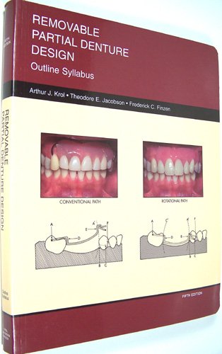 Removable Partial Denture Design: Outline Syllabus B000Q152HY Book Cover