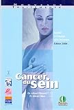 Cancer du sein: Guide à l'usage des femmes