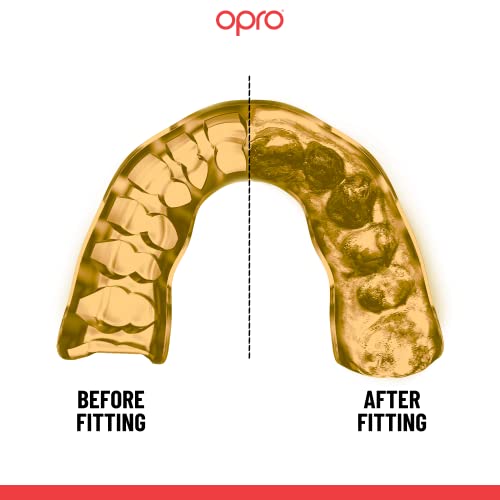 Opro Instant Custom-Fit Mouth Guard, Dentist Mouthguard, Revolutionary Fitting Technology For Ultimate Comfort, Protection And Fit For Football, Wrestling, Boxing, Hockey (White, Adult) #TOP3