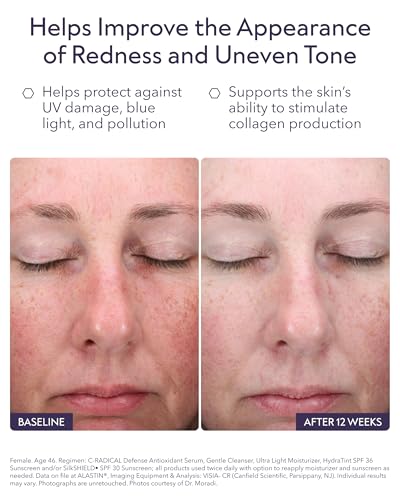 Image of ALASTIN Skincare C-RADICAL Vitamin C Face Serum (1 oz)