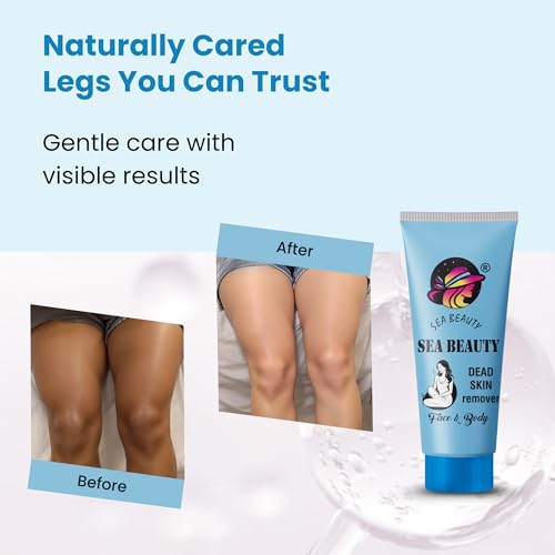 Image of Dead Skin Remover Face & Body Cream | Tan Removal Exfoliator for Smooth and Radiant Skin