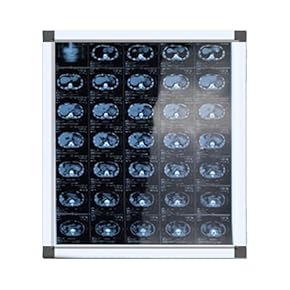 放射線検査学 (X 線) X線透過試験 | KISTEC CONNECT | 神奈川県立産業技術総合研究所