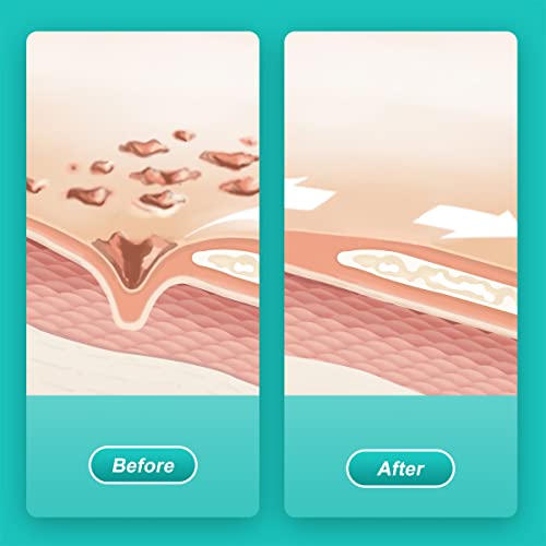 Dimora 2 Packs 6Oz Hydrogel First Aid Ointment, Burn Injory Soothing Gel, Skin Repair Cream For Emergency Burn, Postoperative Incisions, Bruises, Debridement Wound Care #TOP2