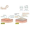Hoosh Face Silicone Pads for Wrinkles (6 Pcs, Reusable), Overnight Hydrating Anti Aging Patches, Botox Tape for Neck, Forehead, Eyes & Smile Lines Treatment, Face & Under Eye Smoothing Mask For Women