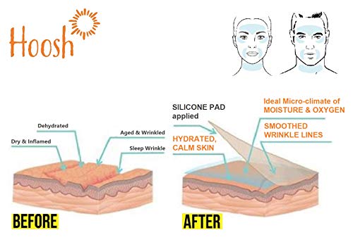 Hoosh Face Silicone Pads for Wrinkles (6 Pcs, Reusable), Overnight Hydrating Anti Aging Patches, Botox Tape for Neck, Forehead, Eyes & Smile Lines Treatment, Face & Under Eye Smoothing Mask For Women