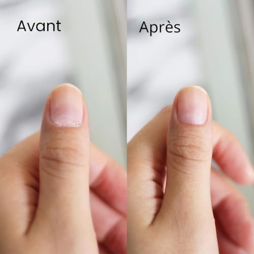 Pince à cuticules & Cuticle Pusher, Coupe-cuticules et outils pour enlever les cuticules en acier inoxydable pour ongles et ongles de pieds Outils de manucure Pédicure – vue 6