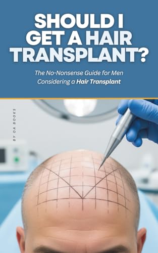 Should I Get a Hair Transplant?: The No-Nonsense Guide for
