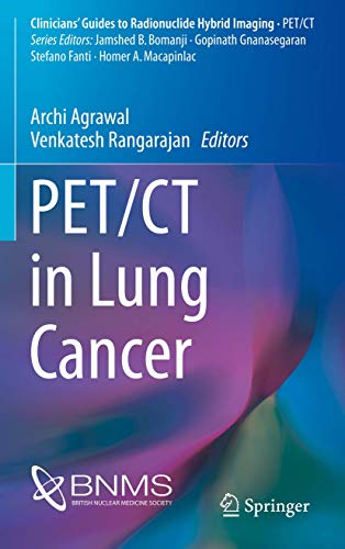 PET/CT in Lung Cancer (Clinicians’ Guides to Radionuclide Hybrid Imaging)