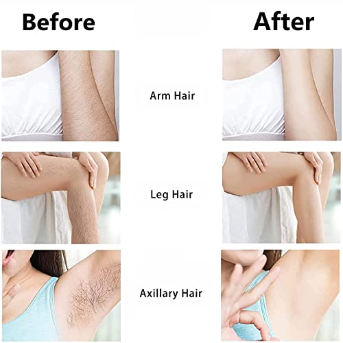 Crystal Hair Eraser For Hair Removal,Crystal Hair Remover For Women And Men,Painless Exfoliation Hair Removal Tool For Arms Legs Back,Reusable & Washable Epilator (Blue) #TOP1