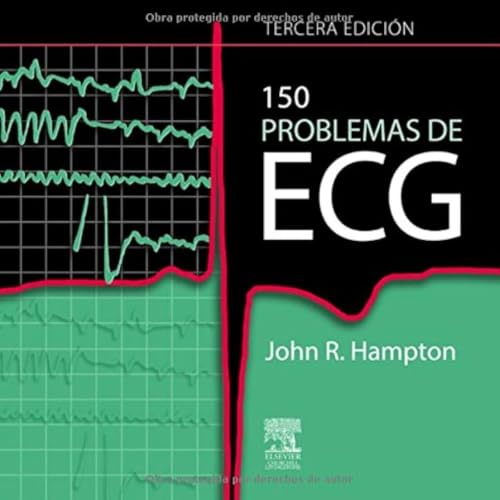150 Problemas De Ecg