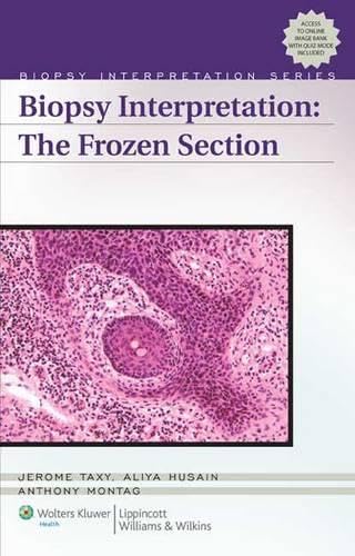 Buy Biopsy Interpretation The Frozen Section (Old) (Biopsy Interpretation Series) — BookShops.in