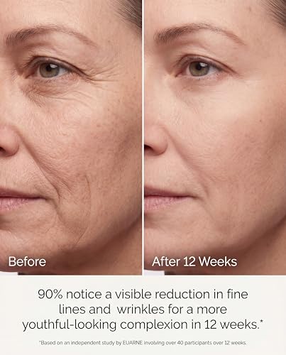 Image of Red Light Therapy for Face, 324 LEDs FDA Cleared | Red Light Therapy Mask, Anti-Fine Line, Anti-Wrinkle, Anti-Acne, Skin Firm, Gift for Women