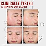 Thayers Blemish Clearing Salicylic Acid Toner, Acne Treatment Face Toner with 2% Salicylic Acid, Soothing and Non-Stripping Skin Care, 12 Fl Oz - Image 5