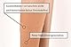 23-32 mmHg ASSISTICA® Medizinische Kompressionsstrümpfe mit offener Spitze, Kniestrümpfe der Klasse 2 für Damen / Herren, Stützstrümpfe ohne Zeh, AD Ersatzstrümpfe (158-170 cm/Large, Beige)
