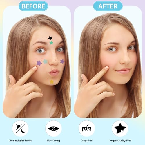 Waspot Pimple Patches for Face, Cute Star Zit Covers, Stars Hydrocolloid, For Sensitive Skin, with Tea Tree, Salicylic Acid & Cica Oil (10&12&14mm) 240 Count
