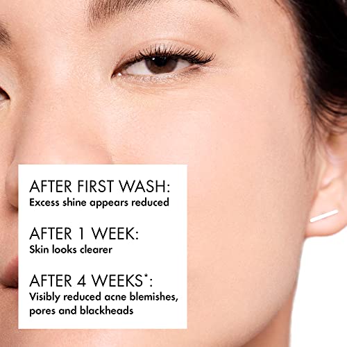 Vichy Normaderm Daily Acne Face Wash, Salicylic Acid Face Cleanser For Oily & Acne Prone Skin, Acne Cleanser That Clears Clogged Pores And Blackheads, Cleansing Gel For Clear Skin #TOP1