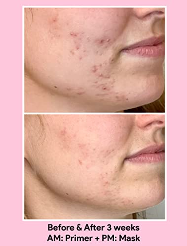 Jori Acne & Oil Control Primer With 2% Salicylic Acid + Botanicals For Adult Skin #TOP3