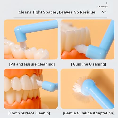 Vonmerie 2 Stück Tuft Zahnbürste, Einbüschelbürste Kleine Zahnbürste Getuftet Weich Büschelzahnbürste Trimm Single Interdental Zwischenraum Bürste(Rosa) – Bild 5