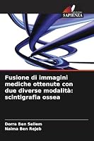 Fusione di immagini mediche ottenute con due diverse modalità: scintigrafia ossea (Italian Edition) 6630443136 Book Cover