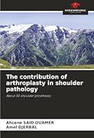 The contribution of arthroplasty in shoulder pathology: About 50 shoulder prostheses 6206818071 Book Cover