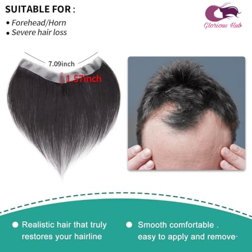 Image of Frontal Hair Patch for Men | Transparent Poly Base | 100% Real Human Hair Toupee | Natural and Invisible Hairline | Easy Fix with Glue or Tape | (Natural Black)