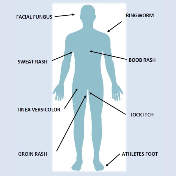 Antifungal Herbal Cream That soothes and relieves. Sweat rash Armpits Groin Jock itch Underboob Gentle Formula Developed by Medical Doctor to Help Your Skin. All Natural - Image 2