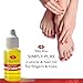 Bliss Kiss | Fragrance Free | Nail Oil Cuticle Dropper w/Vitamin E & Jojoba⏤Nail Strengthener Nail Growth Oil and Serum for Brittle Peeling Breaking Thin Nails | 0.5oz |