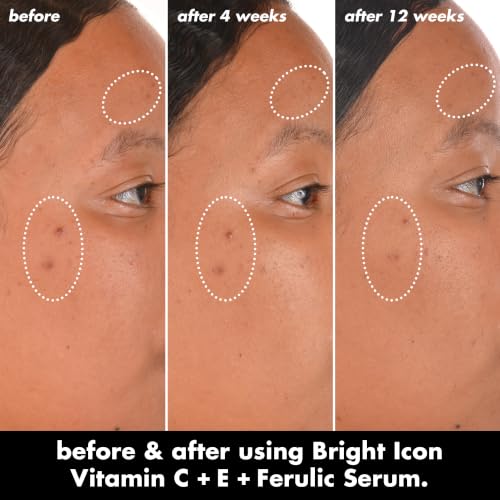 e.l.f. SKIN Bright Icon Vitamin C + E + Ferulic Serum Mini | Brightening Serum with 15% Vitamin C, 1% Vitamin E & 0.5% Ferulic Acid, Helps the Look of Dark Spots, Vegan & Cruelty-Free - image 2