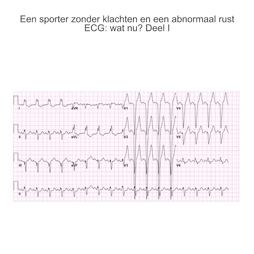 Een sporter zonder klachten en een abnormaal rust ECG: wat nu? Deel I