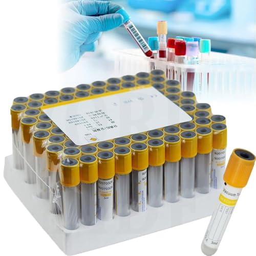 Provette per la raccolta del sangue da laboratorio per la