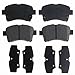 Raybestos SGD937M Service Grade Semi-Metallic Disc Brake Pad Set
