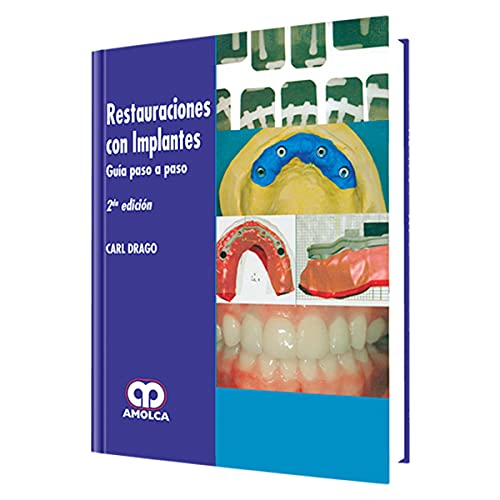Portada de Restauraciones con Implantes. Guia Paso a Paso